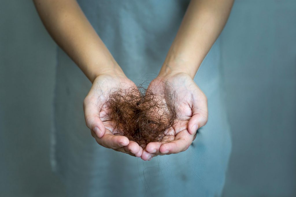 photo of hair loss